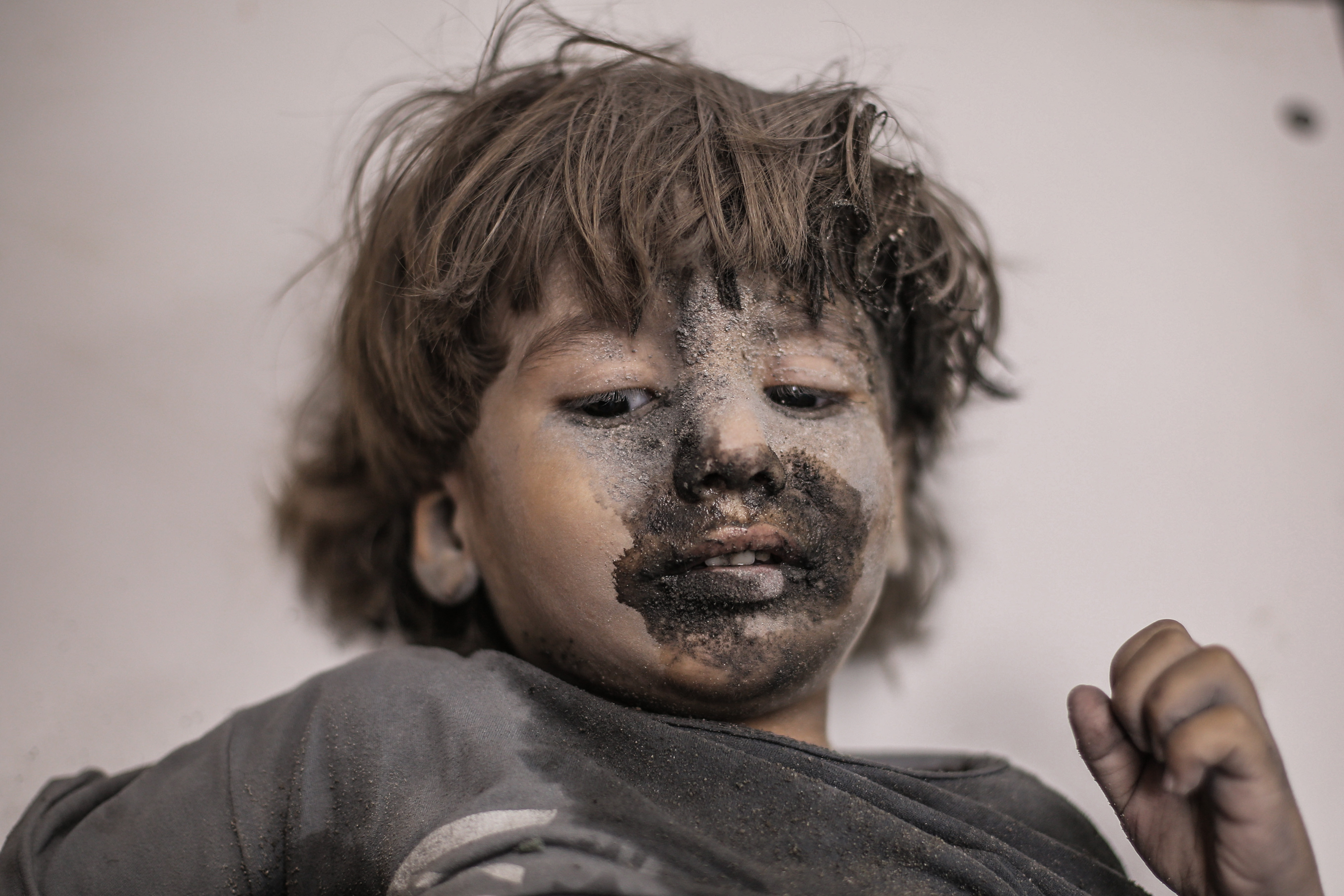 „Îmi vreau picioarele înapoi”. Poveștile tragice ale copiilor „amputați” în războiul din Fâșia Gaza