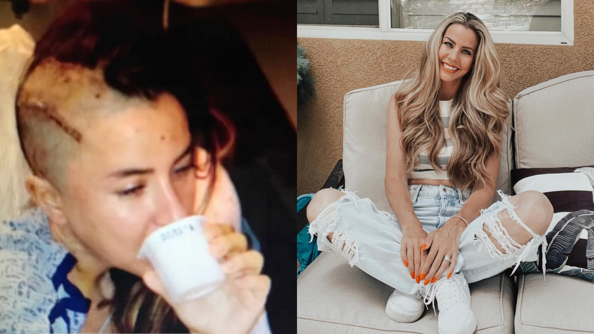 Drama unui fost model, după ce a ajuns să consume votcă în fiecare zi. Urina i se transformase în acid și i-a ars pielea