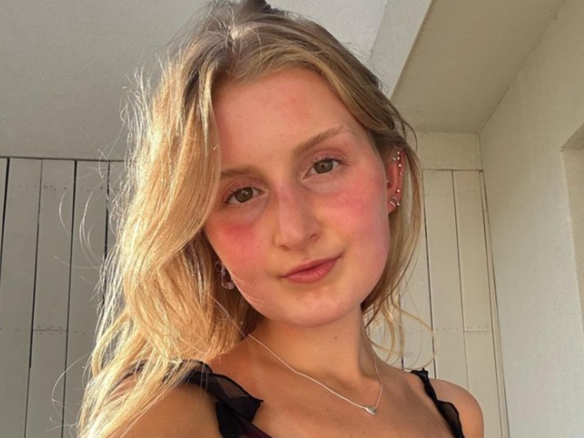 Pielea unei tinere a devenit portocalie după ce a mâncat prea mulți morcovi zilnic