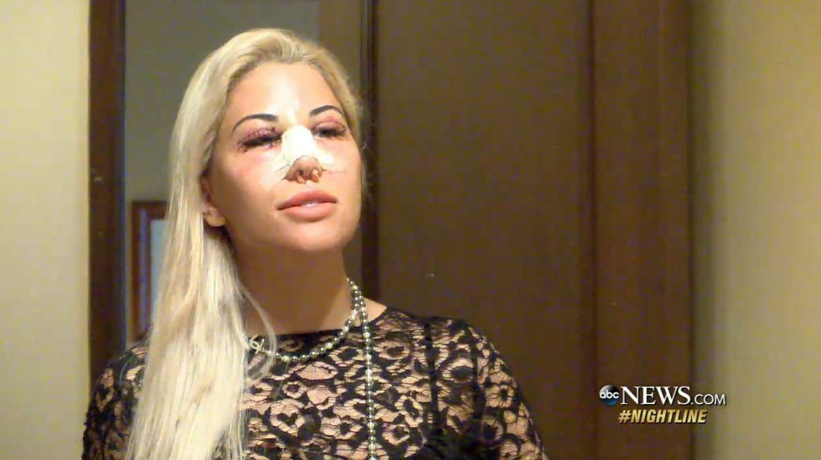 O femeie a cheltuit 60.000 de dolari pentru a arăta ca Ivanka Trump. De ce tot mai multe femei vor să semene cu ea