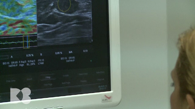 Cancerul la sân și riscurile ignorării vizitelor ginecologice în pre-menopauză