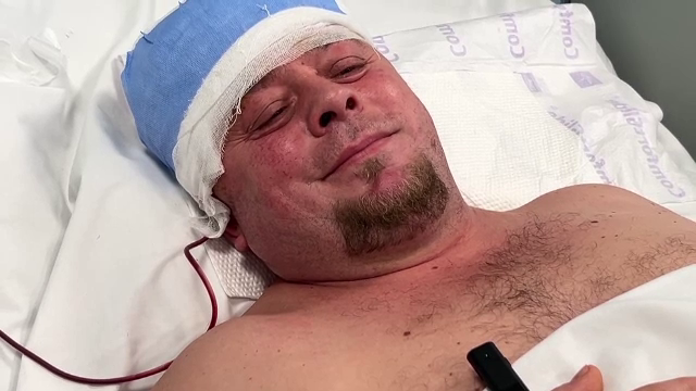 Un bărbat din Târgu Neamț a primit o nouă șansă la viață. Medicii au reușit să-i elimine o tumoare de 8cm de pe creier