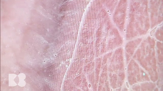 Membranele corpului uman, afectate de poluare: riscuri pentru plămâni, rinichi și sistemul imunitar