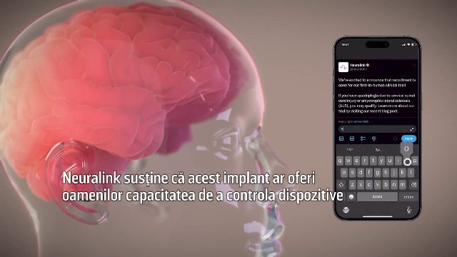 „Hawking ar fi putut transmite un mesaj mai repede decât un dactilograf”. Neuralink a realizat primul implant cerebral
