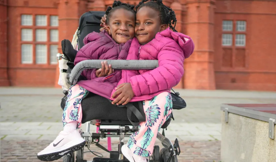 Gemenele siameze care au demonstrat medicilor că greșesc. La naștere s-a spus că nu vor trăi mai mult de câteva zile