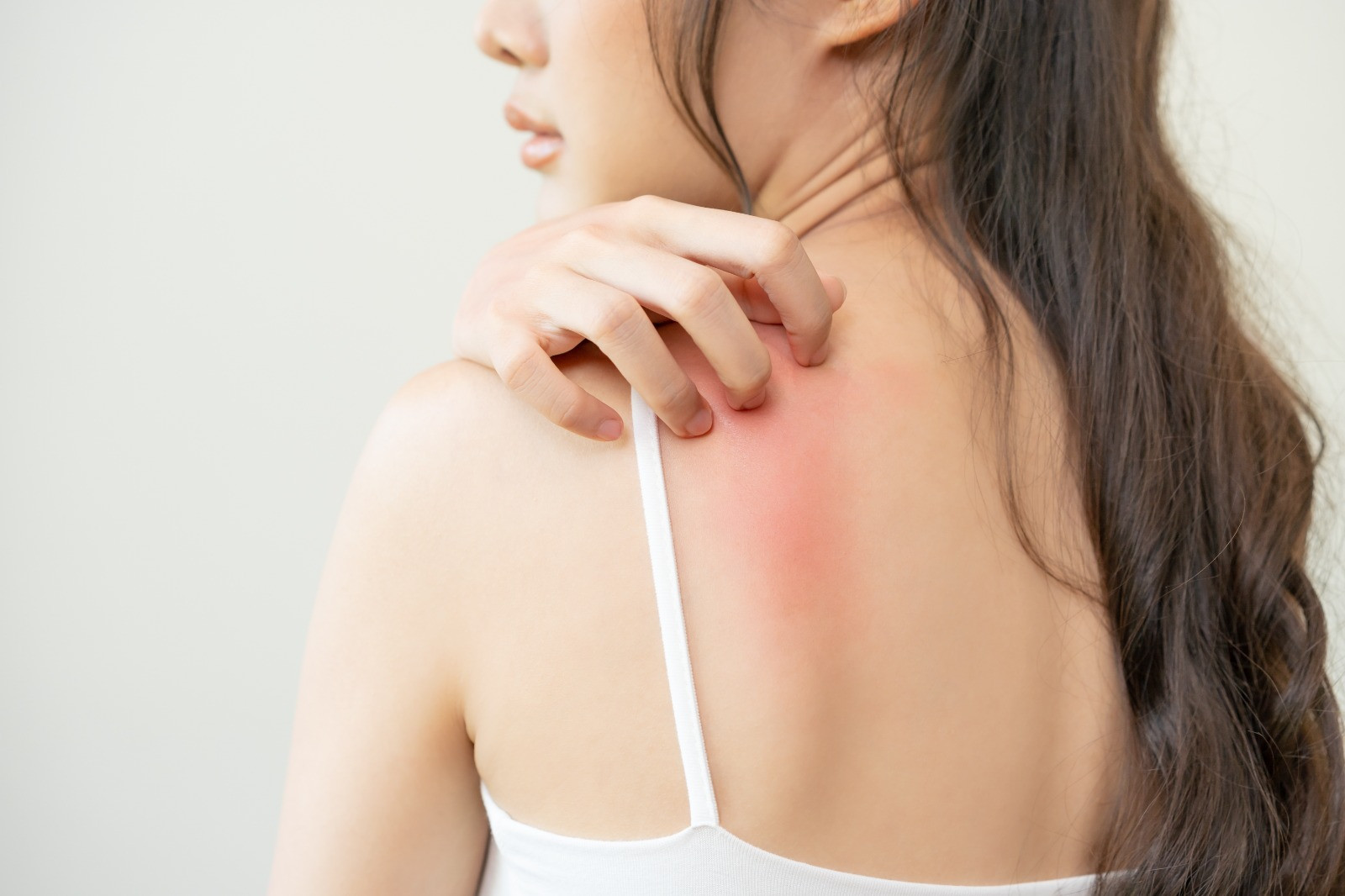 (P) Cum te protejezi de factorii care pot declanșa manifestările dermatitei atopice