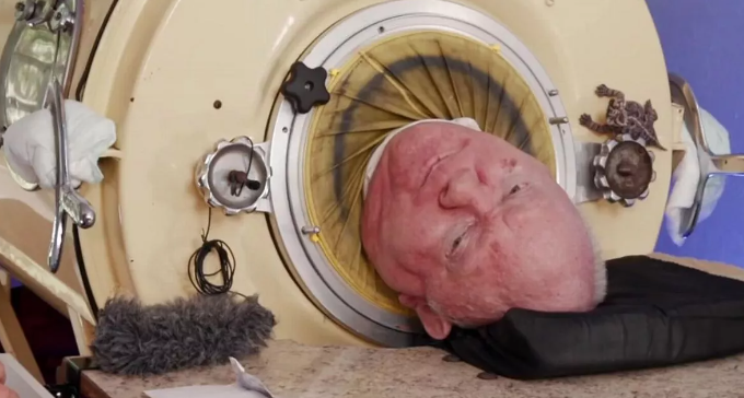 Cum a reușit un bărbat să supraviețuiască într-un „plămân” de fier timp de 70 de ani. Ce s-a întâmplat când avea șase ani