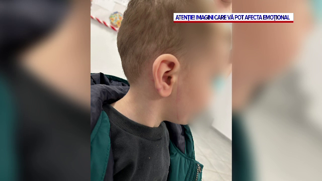 Anchetă la o creșă din Ilfov, după ce părinții unui băiețel au reclamat că micuțul lor de 2 ani a fost bătut