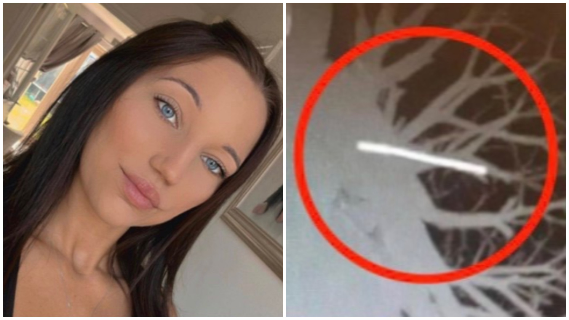 Pățania unei tinere, mamă a doi copii, după ce un implant contraceptiv i-a „migrat” de la subraț în plămâni. „Sunt deprimată”