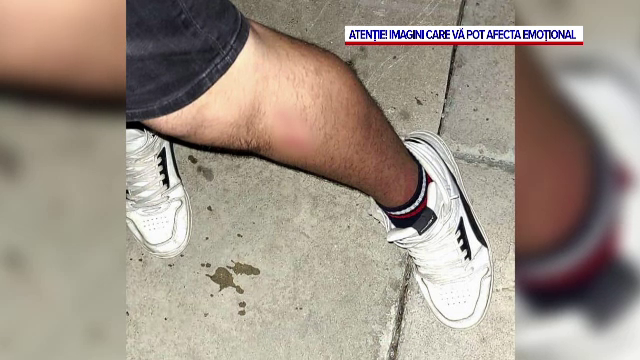 Scene șocante în Constanța. Un elev a fost bătut crunt de tatăl unui coleg. Băiatul încerca să aplaneze un conflict