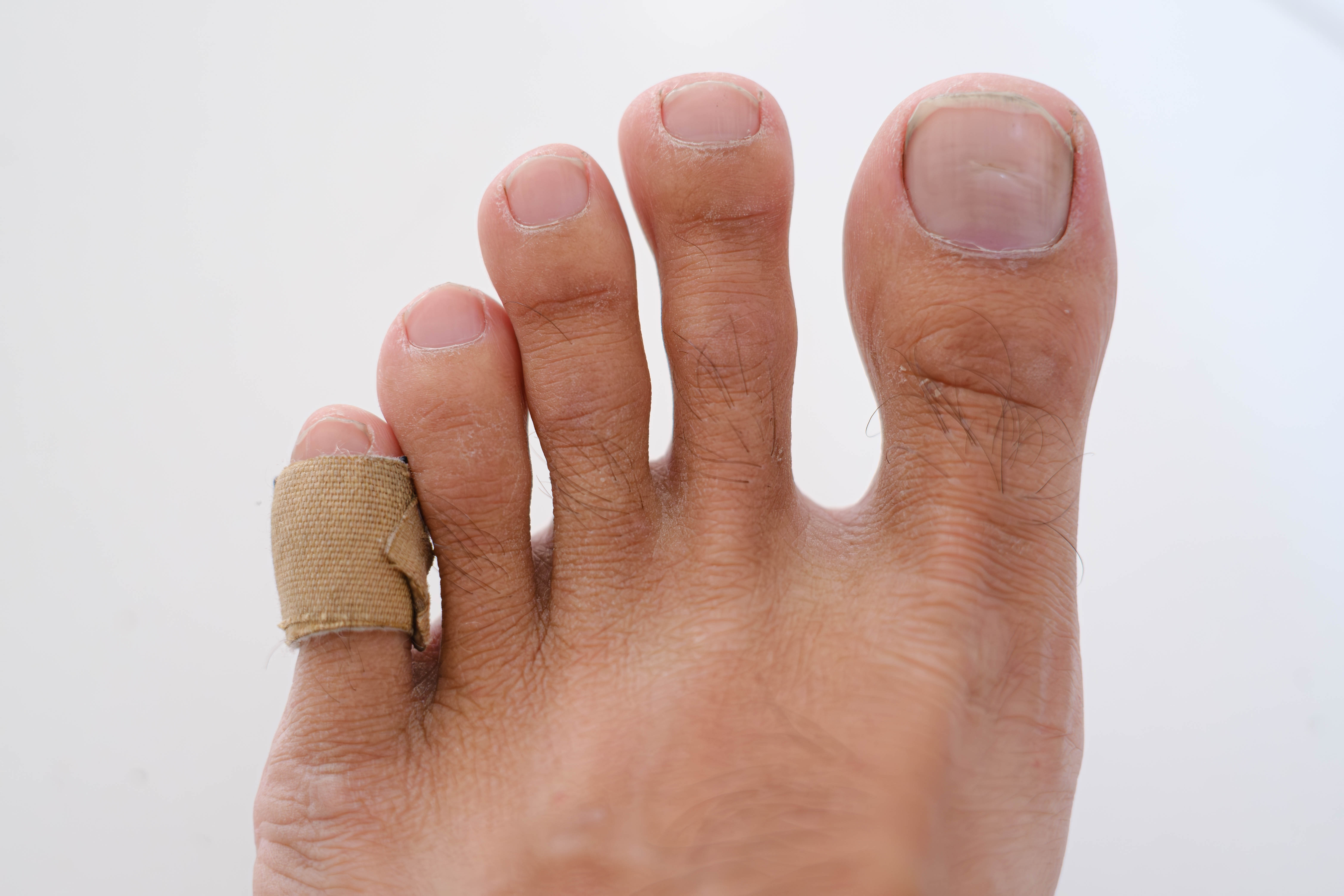 Testul picioarelor care poate depista semnele timpurii ale unei boli grave. Care sunt simptomele „ucigașului tăcut”