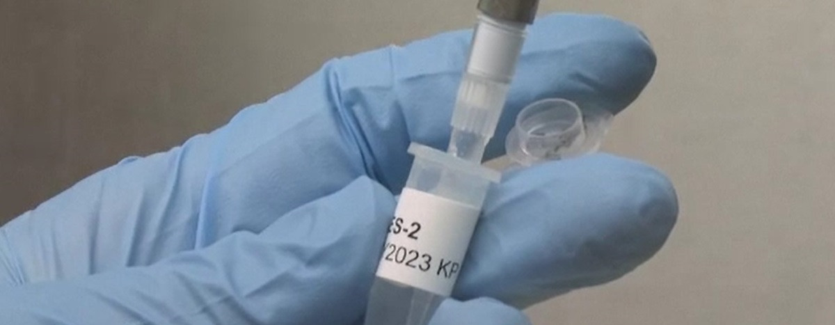 Marea Britanie testează primul vaccin împotriva cancerului de piele. Cum este folosită inteligența artificială