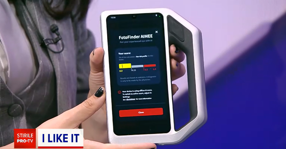 Modalități digitale prin care ne putem verifica rapid alunițele. Primul dispozitiv de acest tip asistat de AI în România