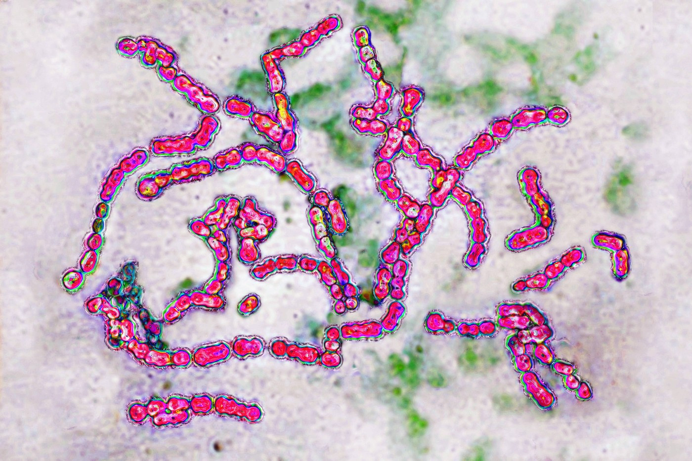 Țara în care o bacterie "mâncătoare de carne" face ravagii. A fost atins un număr record de cazuri