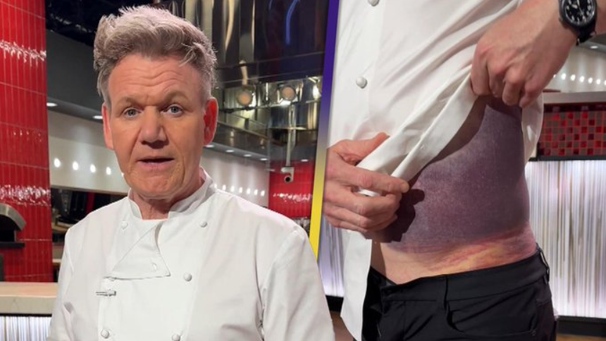 Gordon Ramsay dezvăluie că a avut un accident grav de bicicletă în SUA. Ce le-a transmis fanilor. FOTO