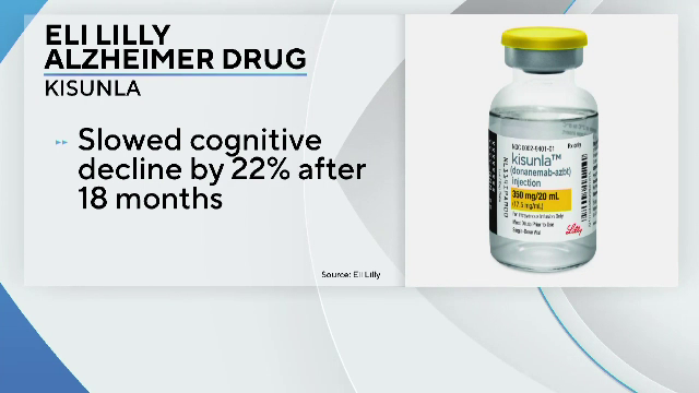 Un nou medicament pentru boala Alzheimer a fost avizat de autoritățile medicale din SUA