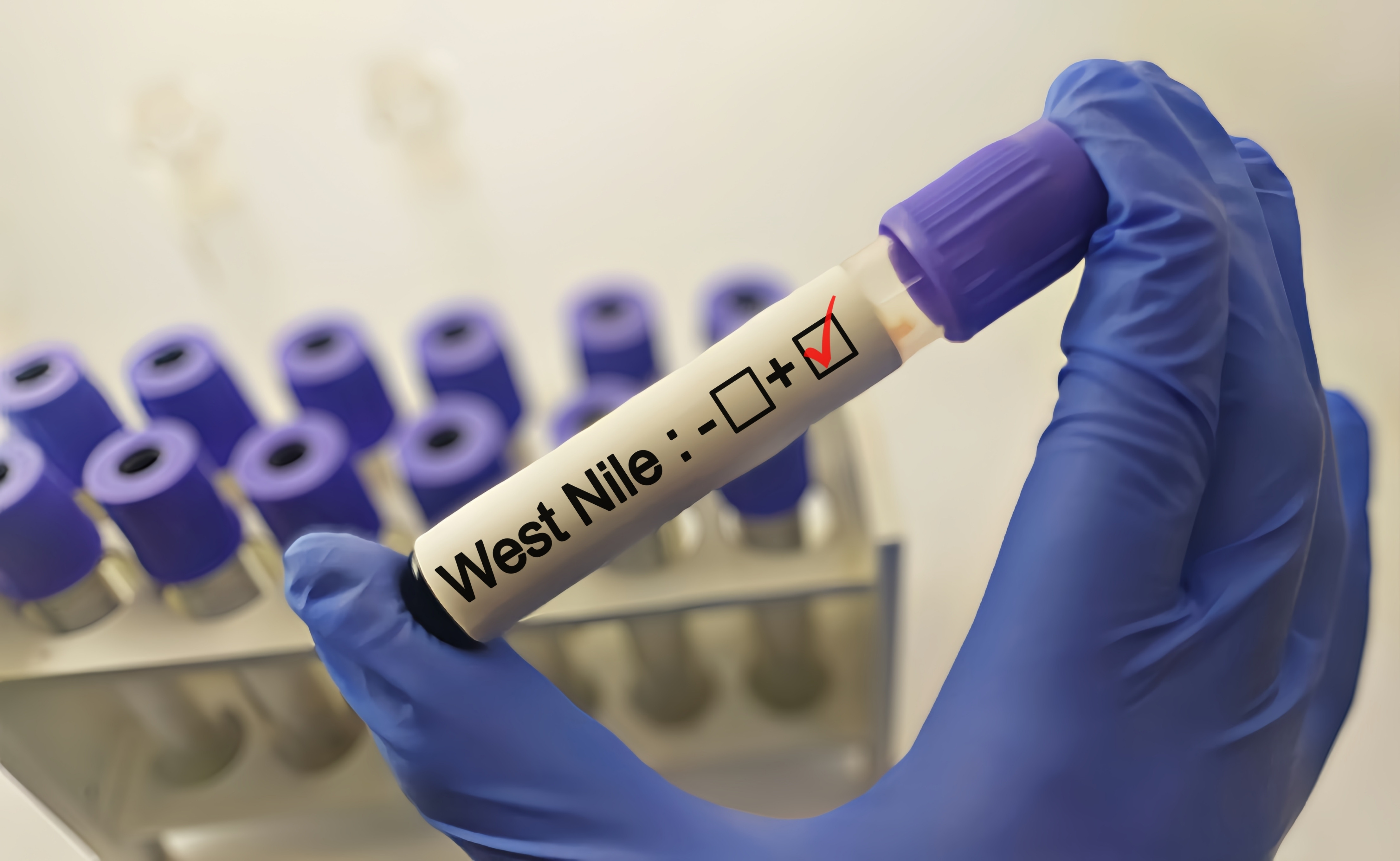 Infecția cu West Nile - care sunt simptomele și cum se tratează