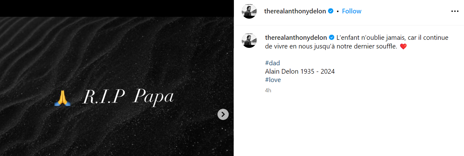Anthony Delon