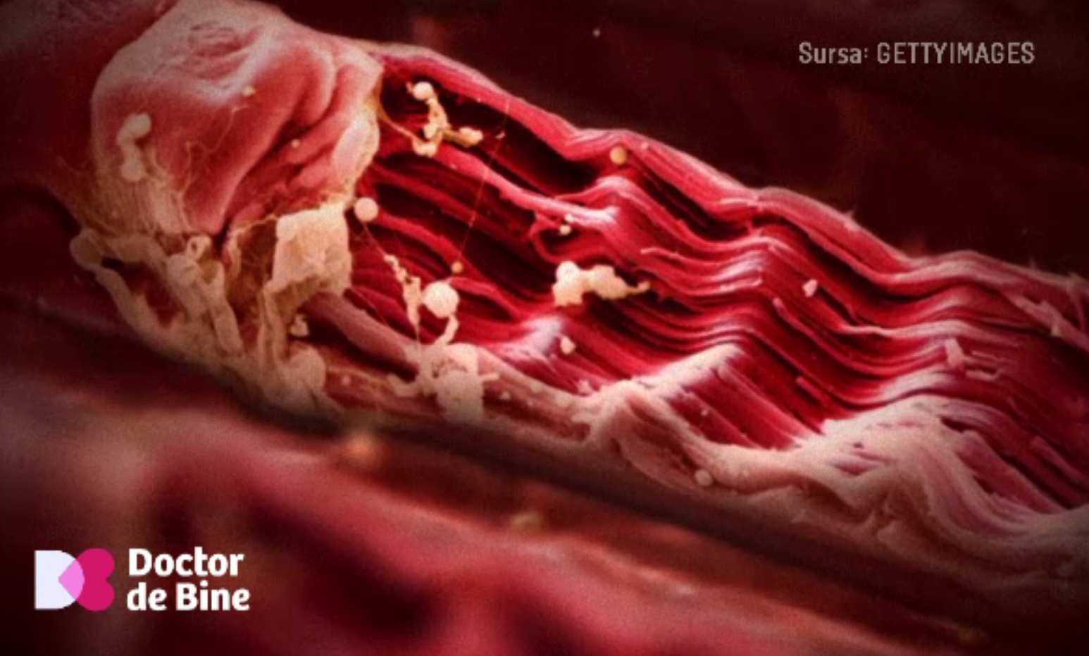 De ce se umflă picioarele și ce legătură are asta cu imunitatea scăzută. Regula celor 10 minute