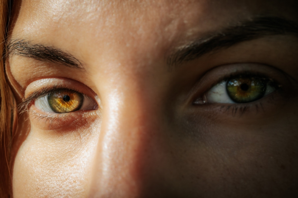 Schimbarea culorii ochilor, o operație care te poate lăsa orb. Cât plătesc pacienții și care este avertismentul medicilor