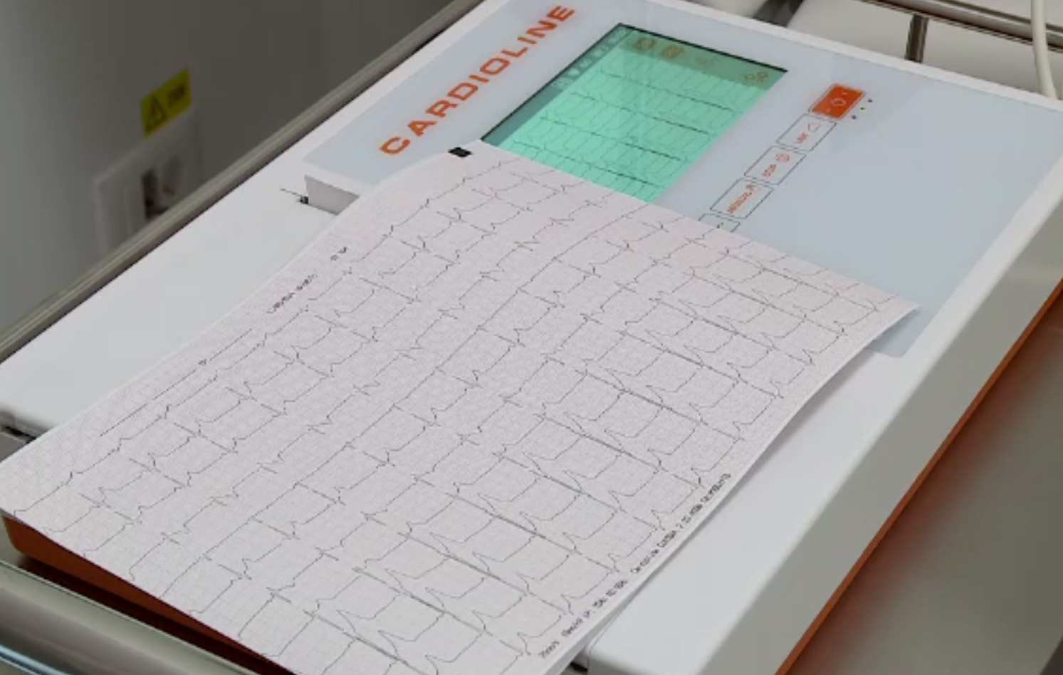 Legătura nebănuită dintre palpitații, fier, tiroidă și rinichi. Ce analize se fac în această situație