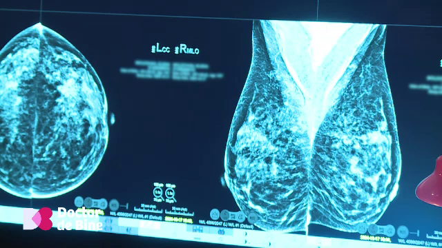 Aproximativ 90% dintre nodulii care apar în sân NU înseamnă cancer, dar controlul anual e singura metodă de prevenție