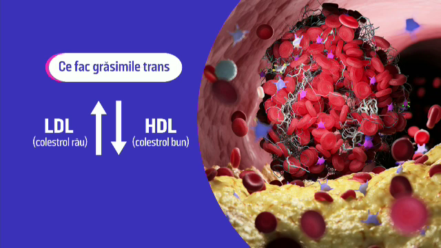 Legătura dintre dulciuri, grăsime, hipertensiune și rinichi. Analiza care trage semnalul de alarmă