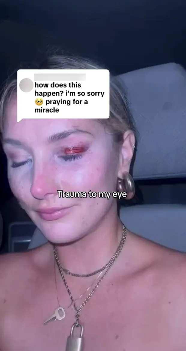 T&acirc;nara lovită cu catarma genții &icirc;n ochi