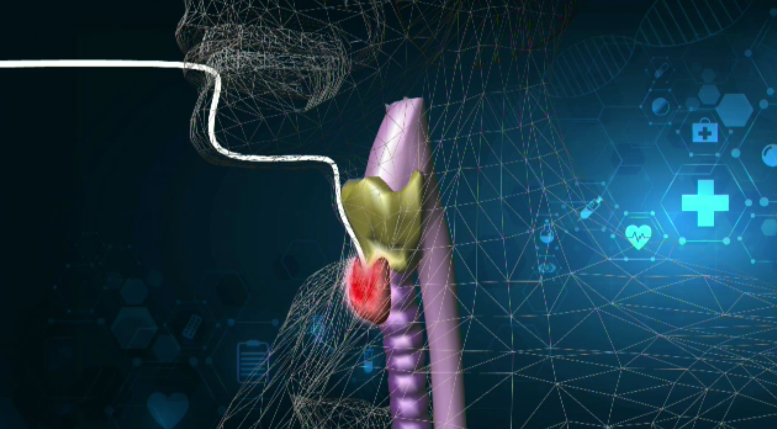 Premieră la Spitalul Elias. Medicii au scos o parte din tiroida unei femei fără să-i lase vreo cicatrice vizibilă