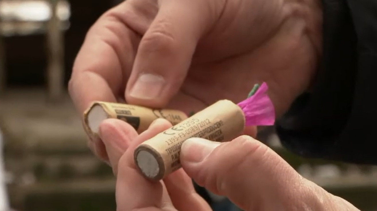 Medicii din Cluj au făcut publică imaginea cu mâna unui bărbat distrusă de o petardă: „A venit chiar în seara de Crăciun”