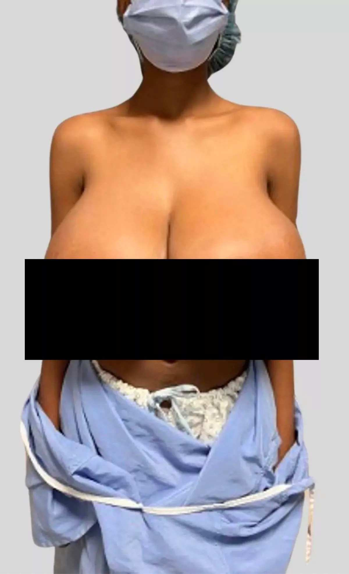 Sanii i-au crescut extrem după injecția cu Pfizer