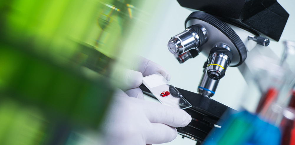 Testul de sânge revoluționar care poate detecta o boală incurabilă cu 10 ani înaintea primelor simptome