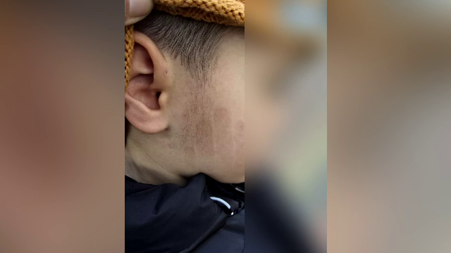 Un copil de 5 ani ar fi fost bătut de îngrijitoare la grădiniță, în Slobozia, pentru că nu ar fi vrut să doarmă