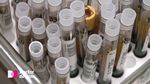 Palpitațiile nu sunt neapărat determinate de afecțiunea inimii. Analizele care arată lipsurile de minerale