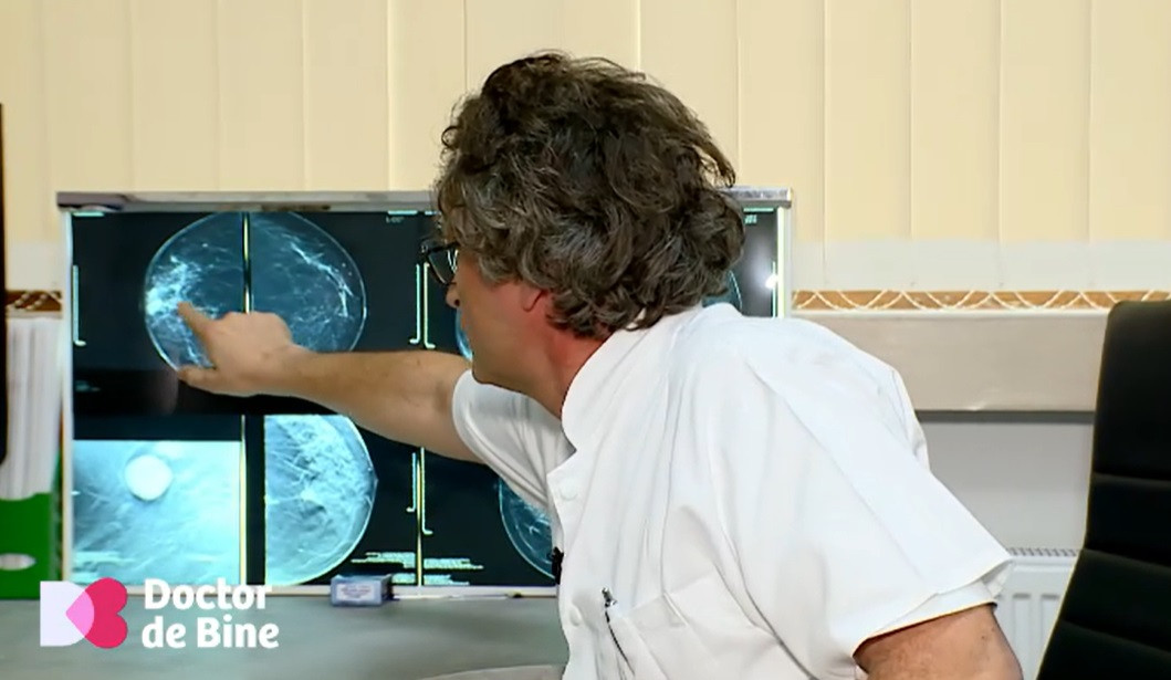 Cancerul la sân. Cum depistăm din timp cea mai frecventă boală oncologică în rândul femeilor