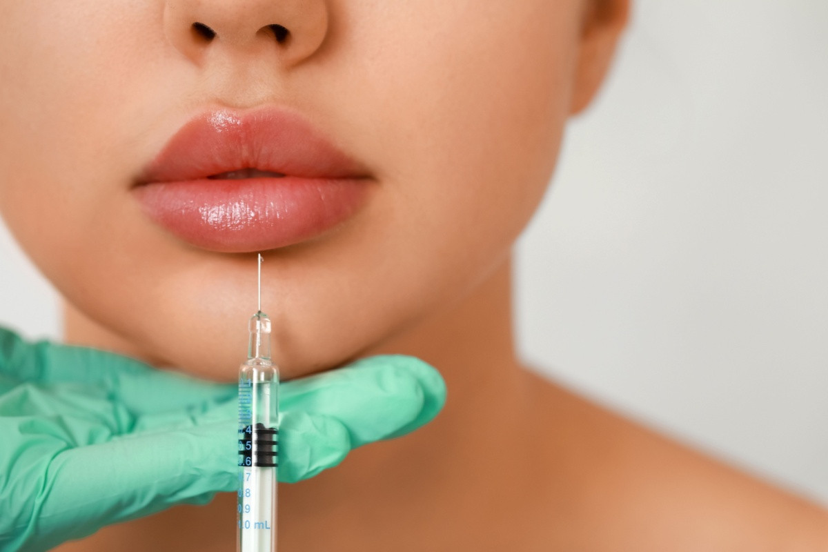 (P) Ce se întâmplă după mărirea buzelor. 5 sfaturi esențiale pentru îngrijirea lor corectă