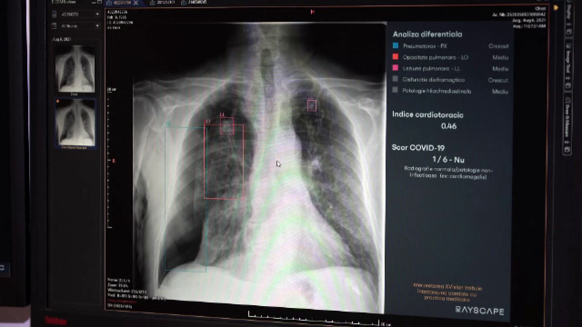 Inteligența artificială, noul aliat al medicilor din România în lupta cu bolile grave. Bolnavii pot primi ajutor mai repede
