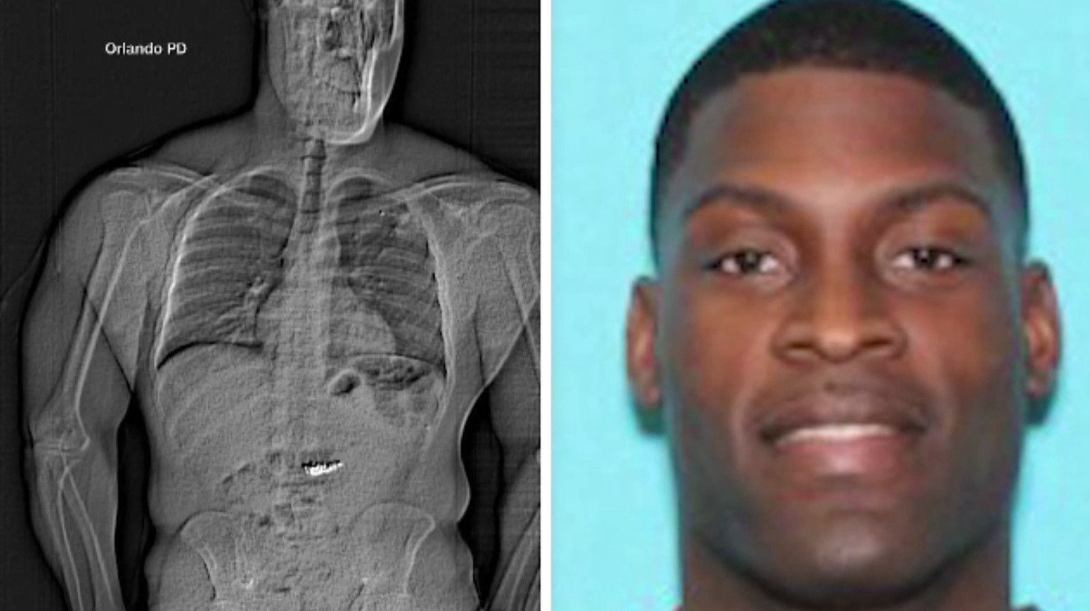 Un hoț din SUA, prins cu diamante în stomac. Ce au văzut polițiștii în timpul radiografiei