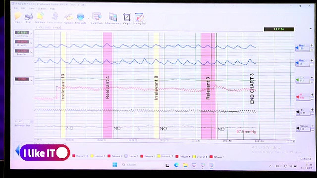 Care sunt secretele testului poligraf. Celebrul detector de minciuni nu mai este folosit doar în anchete, ci și la angajări