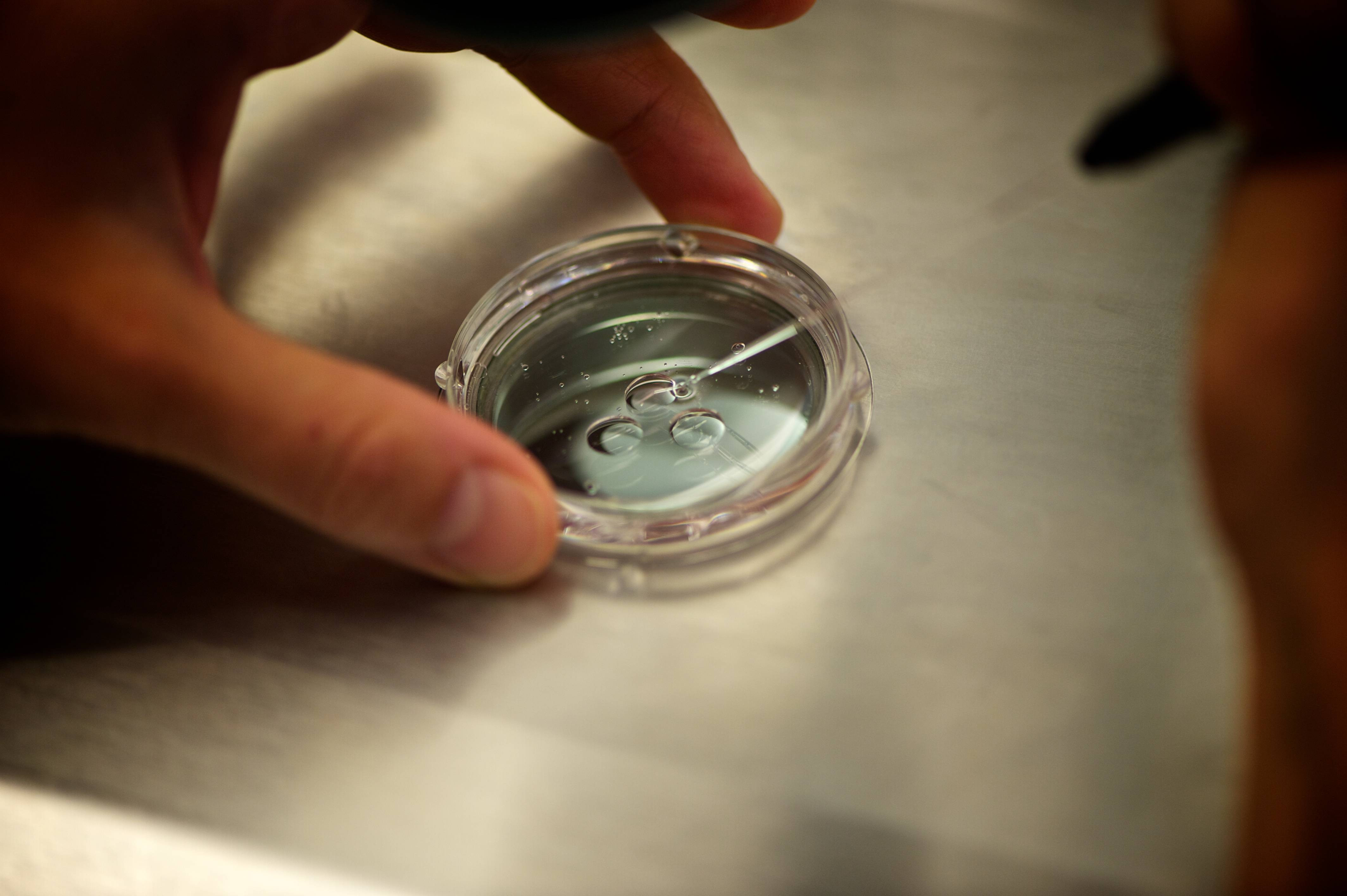 Ignoranța și informațiile de pe net, cele mai ucigătoare ”boli”. Ce se întâmplă, de fapt, când faci o biopsie