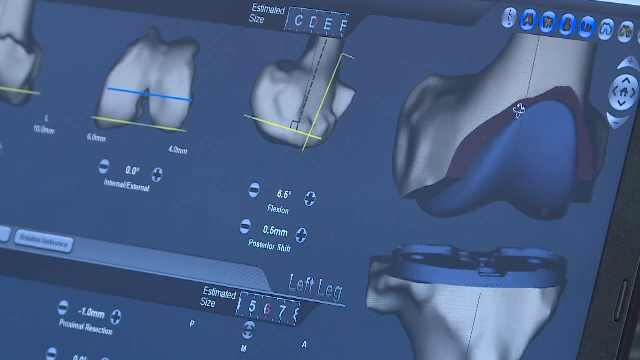 Metoda modernă de tratament a durerilor la umăr, genunchi, șold sau gleznă, fără operație și pastile. Tubulețul „miraculos”