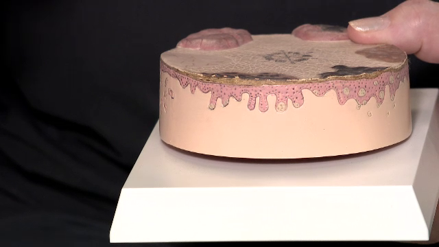 Legătura nebănuită dintre colagen, zahăr și razele ultraviolete. Ce înseamnă colagenul natural