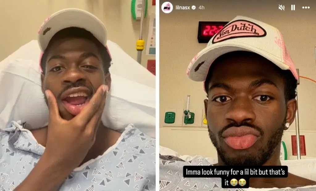 Celebrul rapper Lil Nas X a anunțat că suferă de o paralizie bruscă parțială a feței: ”Nici măcar nu pot să râd cum trebuie”