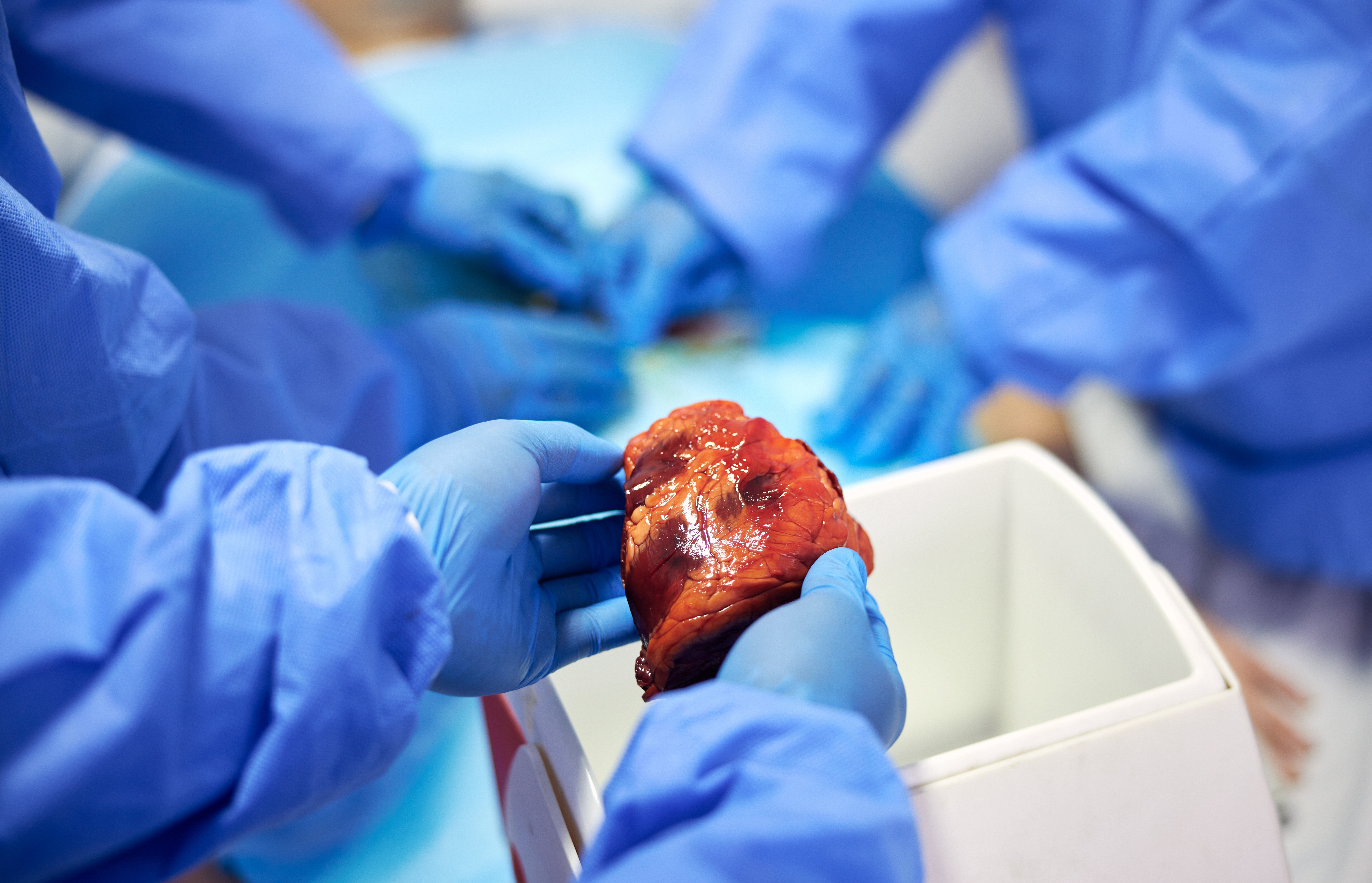 Scandal uriaș de trafic de organe. Europeni disperați plătesc sute de mii de dolari pentru rinichi recoltați în Kenya