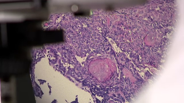 Cum se pot vindeca rănile și cicatricile fără semne. Două metode de tratament diametral opuse