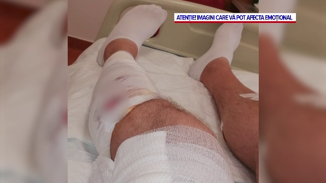 Un bărbat din Cluj a fost mușcat de o haită de c&acirc;ini, &icirc;n timp ce &icirc;ncerca să-și apere fiica de 6 ani.