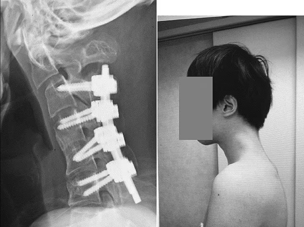 Cum i-au afectat orele petrecute în exces pe telefon sănătatea unui tânăr. Medicii trag un semnal de alarmă