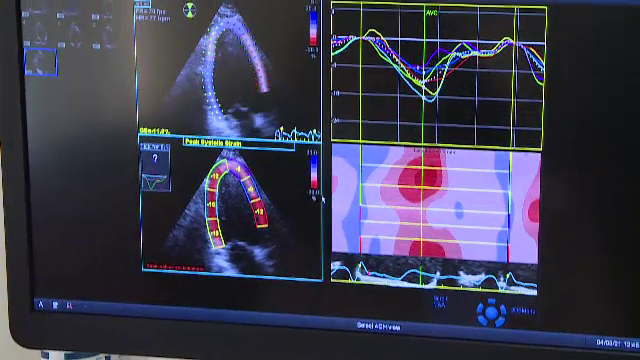 Tot mai mulți bătrâni suferă de „sindromul inimii frânte”. Boala poate duce inclusiv la infarct
