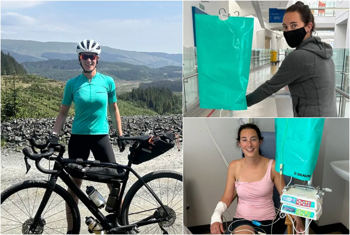 Coșmarul unei femei care credea că suferă de toxiinfecție alimentară. Medicii au fost nevoiți să îi extirpe 13 organe