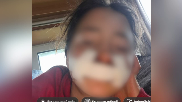 Drama unor fraţi din Arad care au fost bătuți și înfometați de părinți. Tatăl a cusut rana unuia dintre copii cu o sfoară